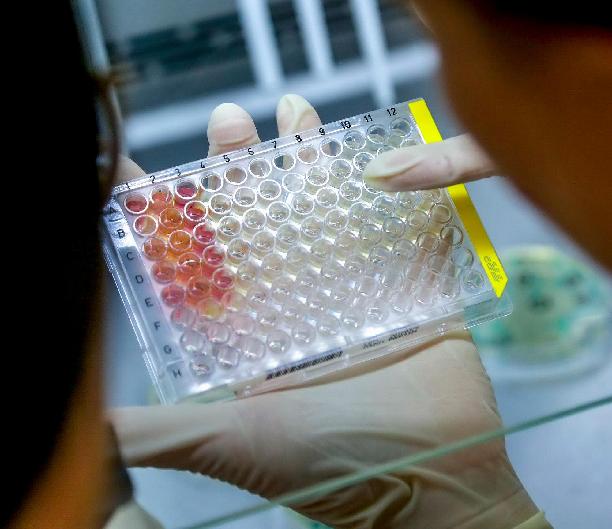 Как усовершенствовать лекарства от оспы — придумали в Новосибирске