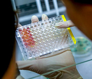 Как усовершенствовать лекарства от оспы — придумали в Новосибирске