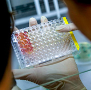 Как усовершенствовать лекарства от оспы — придумали в Новосибирске